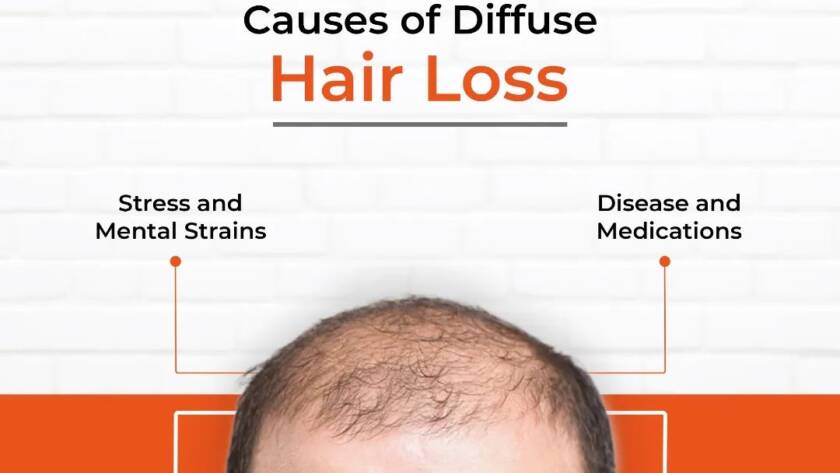 Best Hair Loss Doctors in Bhiwadi