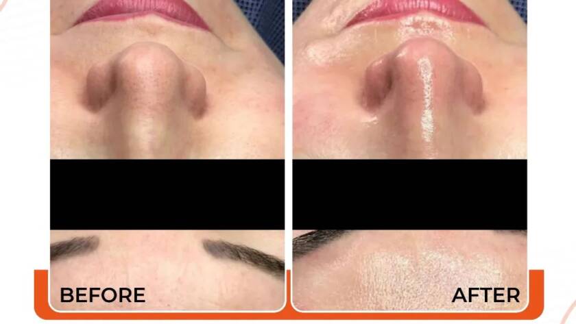 Skin Rejuvenation Treatment Doctors in Bhiwadi