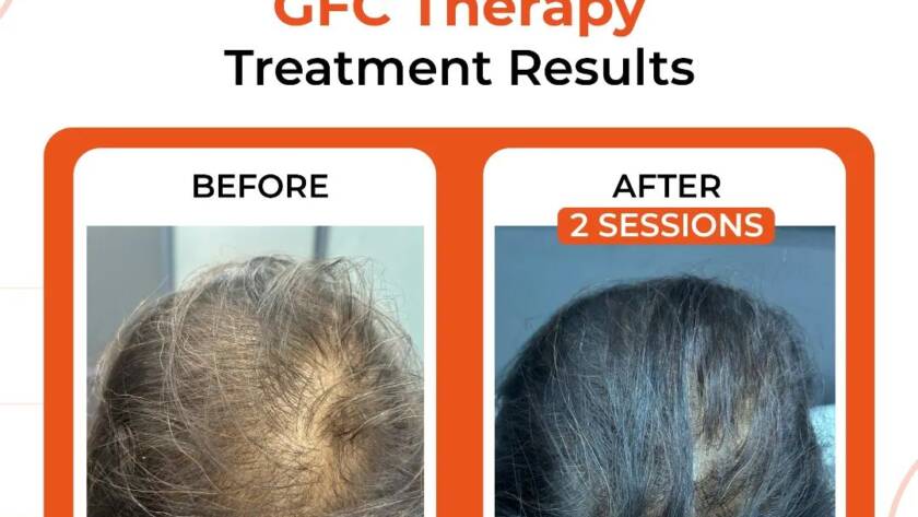 Best GFC Doctor in Bhiwadi