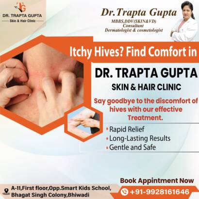Skin Allergies Treatment in Bhiwadi