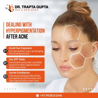 Best Skin Doctor in Bhiwadi
