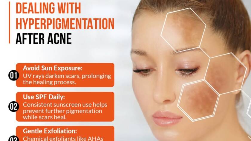 Best Skin Doctor in Bhiwadi