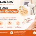 How Long Does Laser Hair Removal Last?