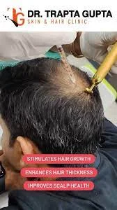 Best Hair Loss Doctors in Bhiwadi